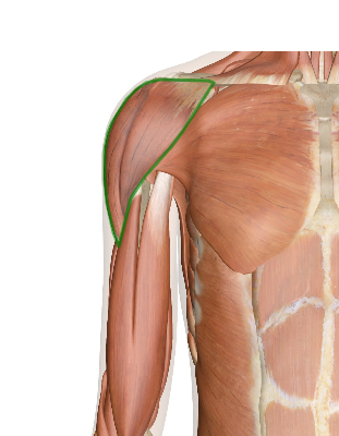 Image and text showing how the Deltoid can cause Muscle Strain