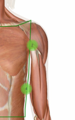 Image and Text showing how Latissimus Dorsi can cause Muscle Strain